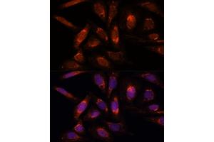 Immunofluorescence (IF) image for anti-Polymerase (RNA) Mitochondrial (DNA Directed) (POLRMT) (AA 42-230) antibody (ABIN7269460)