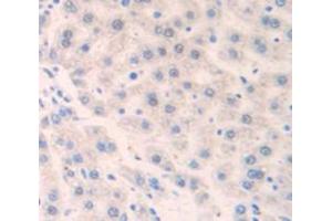 Figure. (MBL2 antibody  (AA 19-244))