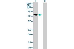 Western Blot analysis of FRS3 expression in transfected 293T cell line by FRS3 MaxPab polyclonal antibody. (FRS3 antibody  (AA 1-492))