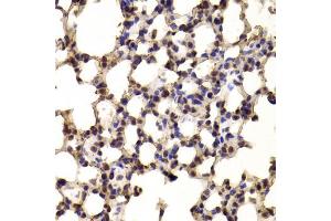 Immunohistochemistry of paraffin-embedded mouse lung using BHLHE40 antibody (ABIN5973918) at dilution of 1/100 (40x lens). (BHLHE40 antibody)