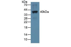 Figure. (CXCL5 antibody  (AA 41-114))