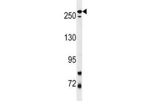 LRRK2 antibody western blot analysis in mouse lung tissue lysate (LRRK2 antibody  (AA 878-909))