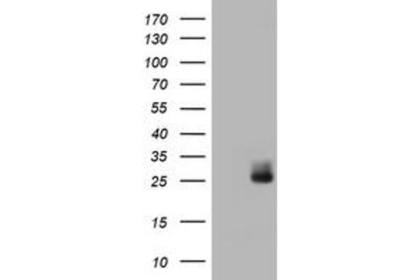 WFDC2 抗体  (AA 31-124)