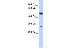 RNF212 antibody used at 1 ug/ml to detect target protein. (RNF212 antibody  (Middle Region))