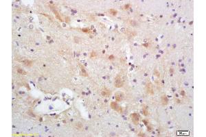 Formalin-fixed and paraffin embedded rat brain labeled with Rabbit Anti CYP5A1/Thromboxane synthase Polyclonal Antibody, Unconjugated (ABIN726065) at 1:200 followed by conjugation to the secondary antibody and DAB staining (PACAP-27/38 (AA 132-169) antibody)