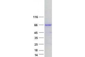 Validation with Western Blot (CLCC1 Protein (Transcript Variant 1) (Myc-DYKDDDDK Tag))