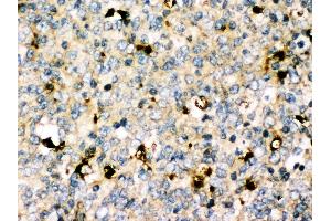 Anti-MyD88 antibody, IHC(P) IHC(P): Human Tonsil Tissue (MYD88 antibody  (Middle Region))