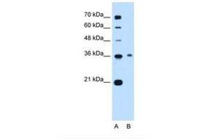 Image no. 1 for anti-Chromosome 11 Open Reading Frame 54 (C11orf54) (C-Term) antibody (ABIN6737988) (C11orf54 antibody  (C-Term))
