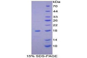 SDS-PAGE (SDS) image for NADH Dehydrogenase (Ubiquinone) 1, alpha/beta Subcomplex, 1, 8kDa (NDUFAB1) (AA 3-129) protein (His tag) (ABIN1879615)