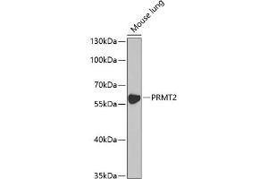 Western blot analysis of extracts of mouse lung, using PRMT2 antibody (ABIN6127447, ABIN6146227, ABIN6146228 and ABIN6221530) at 1:1000 dilution. (PRMT2 antibody  (AA 1-300))