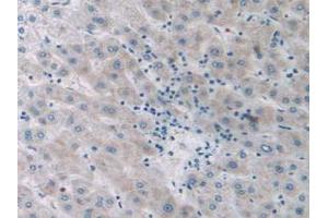 Figure. (SIRT4 antibody  (AA 28-314))