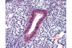 Anti-FOXN1 antibody IHC of human uterus. (FOXN1 antibody  (AA 585-648))
