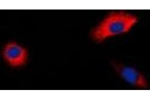 Immunofluorescent analysis of Beta-1 Adrenergic Receptor staining in HepG2 cells. (ADRB1 antibody)