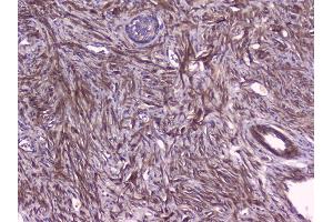 IHC analysis of PBP using anti-PBP antibody (ABIN5693043).