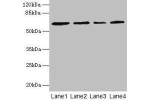 Western blot All lanes: CSGALNACT2 antibody at 4 μg/mL Lane 1: K562 whole cell lysate Lane 2: 293T whole cell lysate Lane 3: Jurkat whole cell lysate Lane 4: PC-3 whole cell lysate Secondary Goat polyclonal to rabbit IgG at 1/10000 dilution Predicted band size: 63, 39 kDa Observed band size: 63 kDa (CSGALNACT2 antibody  (AA 33-270))
