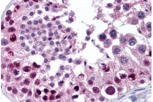 Human Testis (formalin-fixed, paraffin-embedded) stained with MTA2 antibody ABIN301765 at 10 ug/ml followed by biotinylated goat anti-rabbit IgG secondary antibody ABIN481713, alkaline phosphatase-streptavidin and chromogen. (MTA2 antibody  (AA 650-700))
