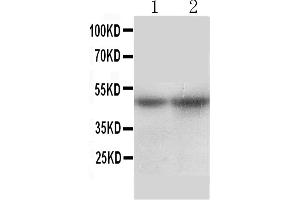 Anti-SLC10A1 antibody, Western blottingAll lanes: Anti SLC10A1  at 0. (SLC10A1 antibody  (Middle Region))