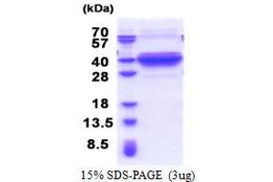 SDS-PAGE (SDS) image for Dynein, Axonemal, Light Intermediate Chain 1 (DNALI1) (AA 1-280) protein (His tag) (ABIN5853347)