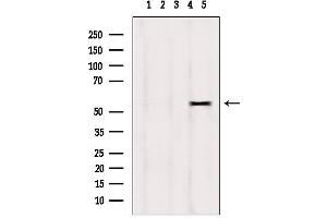 Western blot analysis of extracts from hepg2, using DPP4 antibody. (DPP4 antibody  (C-Term))