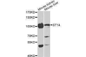 Western blot analysis of extracts of various cell lines, using ST14 antibody (ABIN6293606) at 1:1000 dilution. (ST14 antibody)
