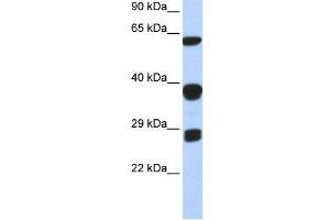 WB Suggested Anti-SNRPB  Antibody Titration: 0. (SNRPB antibody  (Middle Region))