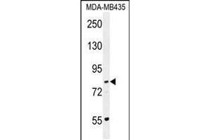 Western blot analysis in MDA-MB435 cell line lysates (35ug/lane). (PCDHGA1 antibody  (AA 287-315))