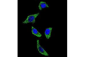 Confocal immunofluorescent analysis of TNFRSF1A Antibody (N-term) (ABIN655208 and ABIN2844822) with U-251MG cell followed by Alexa Fluor 488-conjugated goat anti-rabbit lgG (green). (TNFRSF1A antibody  (N-Term))