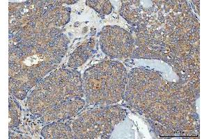 IHC analysis of RPL32 using anti-RPL32 antibody (ABIN7602916).