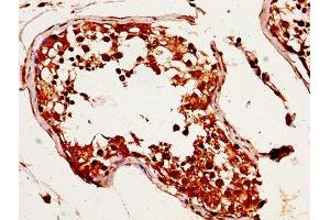 IHC image of ABIN7159296 diluted at 1:320 and staining in paraffin-embedded human testis tissue performed on a Leica BondTM system. (MAGED2 antibody  (AA 38-285))