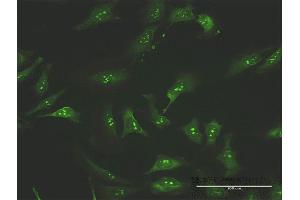 Immunofluorescence of purified MaxPab antibody to FNTA on HeLa cell. (FNTA antibody  (AA 1-214))