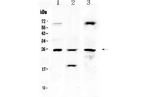 Western blot analysis of TIMP4 using anti- TIMP4 antibody .