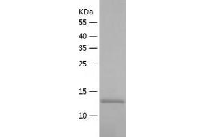 CTCF Protein (AA 1-154) (His tag)