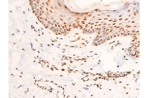 ABIN6267306 at 1/100 staining human skin tissue sections by IHC-P. (C-JUN antibody  (pThr91))