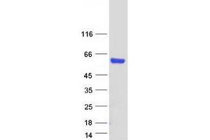 Validation with Western Blot (T-Box 1 Protein (TBX1) (Transcript Variant C) (Myc-DYKDDDDK Tag))