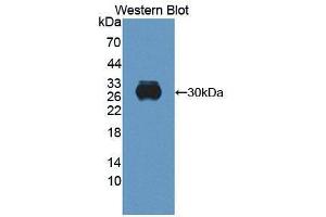 Western blot analysis of the recombinant protein. (Retbindin antibody  (AA 32-247))