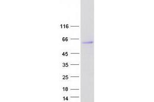 Homocysteine-Inducible, Endoplasmic Reticulum Stress-Inducible, Ubiquitin-Like Domain Member 1 (HERPUD1) (Transcript Variant 1) protein (Myc-DYKDDDDK Tag)