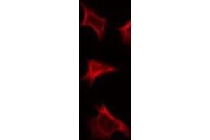 ABIN6275840 staining HepG2 by IF/ICC. (DDR1 antibody  (Internal Region))