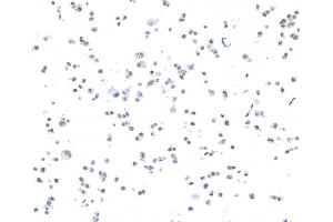 Immunocytochemistry (ICC) image for anti-CCCTC-Binding Factor (Zinc Finger Protein) (CTCF) (AA 650-700) antibody (ABIN7453967)