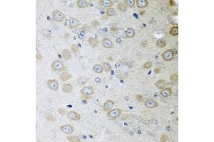 Immunohistochemistry of paraffin-embedded mouse brain using ATAD3A antibody. (ATAD3A antibody)