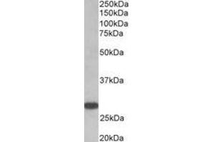 Image no. 1 for anti-Thyroid Stimulating Hormone Receptor (TSHR) (AA 101-115), (Extracellular Domain) antibody (ABIN1104855) (TSH receptor antibody  (Extracellular Domain))