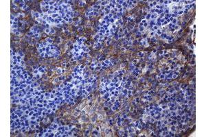 Image no. 2 for anti-Cadherin 1, Type 1, E-Cadherin (Epithelial) (CDH1) antibody (ABIN1497941) (E-cadherin antibody)