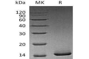 Western Blotting (WB) image for Colony Stimulating Factor 2 (Granulocyte-Macrophage) (CSF2) (Active) protein (ABIN7320537) (GM-CSF Protein)