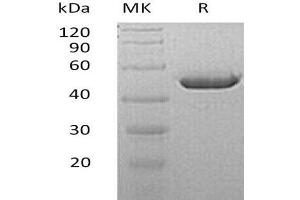 CA4 Protein (AA 17-420) (His tag)