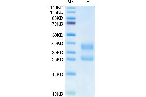 Biotinylated Human CD3E&CD3D on Tris-Bis PAGE under reduced condition. (CD3D & CD3E (AA 23-120) protein (His tag,Biotin))