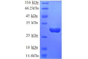 SDS-PAGE (SDS) image for Tachykinin Receptor 1 (TACR1) (AA 1-29) protein (GST tag) (ABIN1095761)