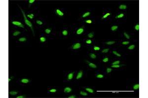 Immunofluorescence (IF) image for anti-Minichromosome Maintenance Deficient 4 (MCM4) (AA 1-863) antibody (ABIN950014)