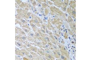 Immunohistochemistry of paraffin-embedded human liver using WDR48 antibody. (WDR48 antibody  (AA 450-677))