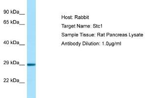 WB Suggested Anti-Stc1 Antibody   Titration: 1.