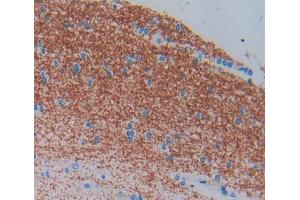 Used in DAB staining on fromalin fixed paraffin- embedded brain tissue (ELMO2 antibody  (AA 501-720))