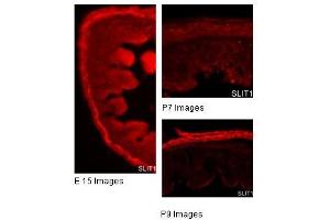SLIT1 antibody used at a concentration of 2 and 10 ug/ml to detect gut tissue. (SLIT1 antibody)